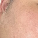 천안리턴병원 | 예신의 깐달걀 만들기 프로젝트 천안 불당동<연뷰티>