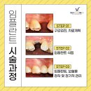 민승기브이라인치과의원