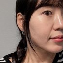 트리플 | 홍대 피부과 : 팔자주름 고민해결 : 원더트리플 실리프팅 리얼 후기 ⁎⁺˳✧༚