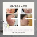 최미경 | 로덱스화장품 최미경대표님 덕분에 피부가 좋아졌어요_고객 후기