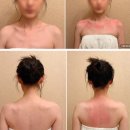 빛빗다 | 잠실 승모근없애기 피부관리 위뷰티 잠실점 예신 필수코스 후기