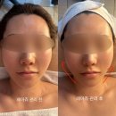 첨단과기로 | [첨단피부관리]연예인 윤곽관리 배워오신 원장님 메디케어 스킨앤바디