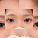 모아레스튜디오 | 잠실 노글루펌 잘하는곳은 모아레스튜디오🫶🏻