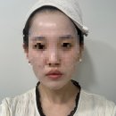 위드니노 | 피지, 모공관리에 좋은 위드니노 “ 피르가즘 오아팩” N 번째 내돈내산 후기