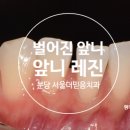 수지좋은치과의원 이미지
