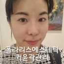 내돈내산 폴라리스에스테틱 퀵윤곽관리 재방문 후기