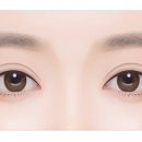 강남뷰티업성형외과 이미지