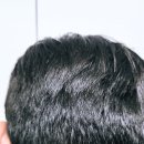 헤어살롱엠(Hair salon M) | 비듬가려움 두피관리방법 M자탈모 남자전용 모근강화샴푸추천