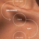 에스테틱오프