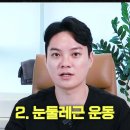 안검하수 예방 이미지