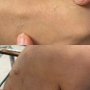 인온투 셀프왁싱 제모크림
