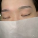 아인뷰티의원 이미지