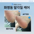 (주)앤드솔루션 | 부산 화명동 프리앤드가 알려주는 겨울 발각질 관리 중요한 이유