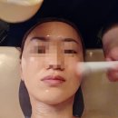 마포피부관리샵 &#39;로이에스테틱&#39; 울트라ex관리 후기