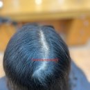 르네시떼 이미지