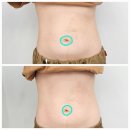 하가목 | 전주 복부해독관리 집중 케어 라인과 순환을 동시에 잡고 싶다면 올가드림뷰티 하가점에서!