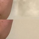 언주역 피부관리 가꾸다 웨딩케어 후기