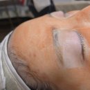 나투어에스테틱 | 용인피부관리 역북동 나투어 에스테틱 피부관리 후기