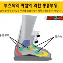 피봇팅(Pivoting)에 의한 스키의 회전운동과 그로인한 문제점 이미지