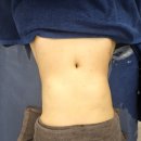 순천다이어트 추천 순천피부관리 순천다이어트 전문 카리스에스테틱 슬림관리 후기