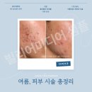마곡 여드름 흉터 치료 피부과 고르는 기준