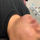 더스무스 죽전역점 네이버블로그