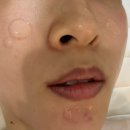 샤넬케어 | 사직동 피부관리 윤곽관리 추천 라비뉴 에스테틱 샤넬광채케어 물광관리 후기