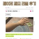 글램외과의원 | 레이저 제모/ 효과 좋고 통증 없는 레이저 제모 생생 후기