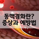 경화 이미지
