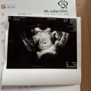 이브야, 환영해