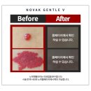 노박젠틀브이의원 이미지