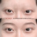 하루눈썹 이미지