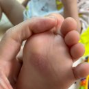 성동병원 | 아기 화상 병원 성동구 베스티안 서울병원 응급실 후기