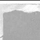 뉴진성형외과의원 이미지