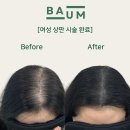 바움SMP