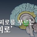 만성피로를 부르는 뇌피로 이미지