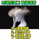 멍머리 이미지