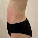 학하서로 | 대전 복부관리 산후관리 [뷰티오늘] 복부슬리밍 관리 단 1회만에 배 홀쭉