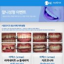 서울원치과 이미지