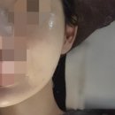 스파리스 | 수지 성복동 미누림 크라이오셀 피부관리