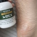 아시모토 노젠 EX 스프레이 후기 문제성발을 탈출해보자
