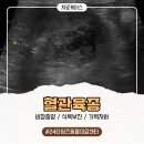 타임즈 동물의료센터 | 강아지 비장종양 - 타임즈 동물의료센터