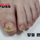 레푸스 사상점 이미지