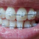 예바치과교정과의원 이미지