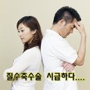 질수축수술 다시 태어난 기분