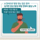 호흡기 증상 없는 환절기 몸살 '뇌경색' 이미지