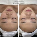 다움스킨 이미지
