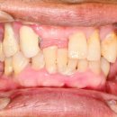 아치치과기공소 이미지