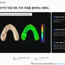 클리어(clear) 치과기공소 | 9분만 기다리면 환자가 대기실에 앉아 있는 동안 모델이 나옵니다 — Formlabs Form 4B