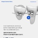 심플교정 이미지